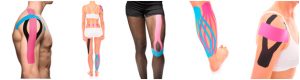 kinesio tape